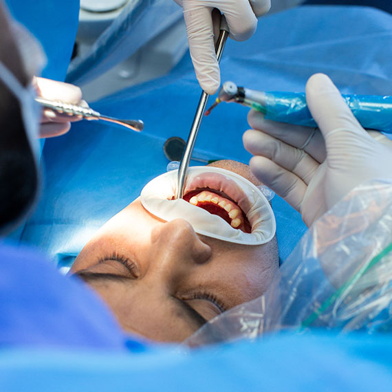 Advanced periodontal technique in Vancouver