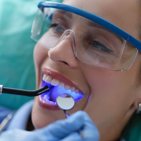 Cosmetic dental bonding in Vancouver