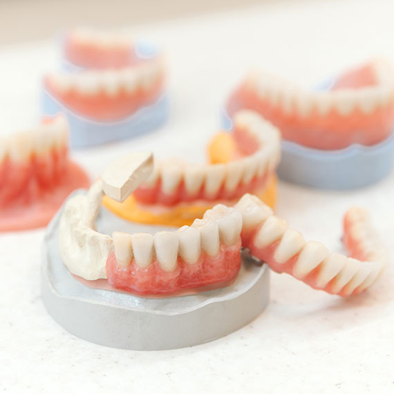Dental implant near you