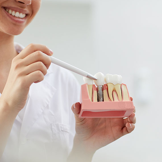 Dental implants near you