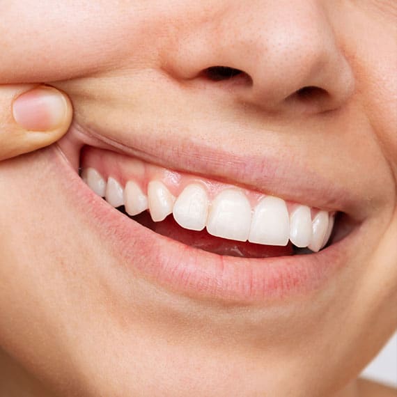 Gum Recontouring in Vancouver