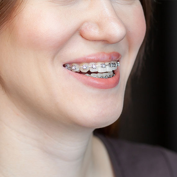 orthodontics