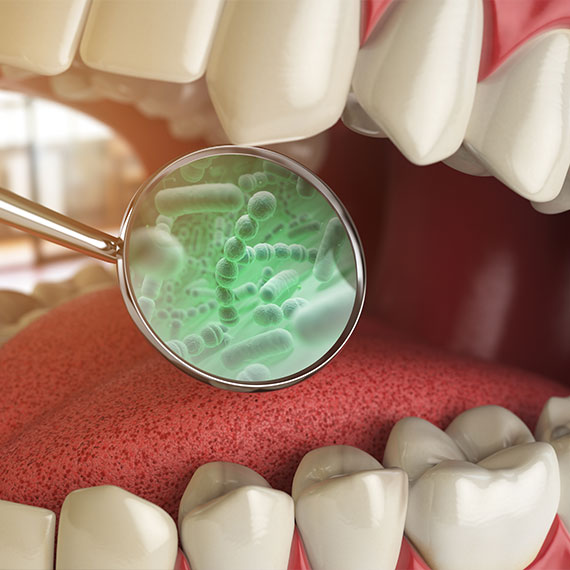 Periodontitis near you