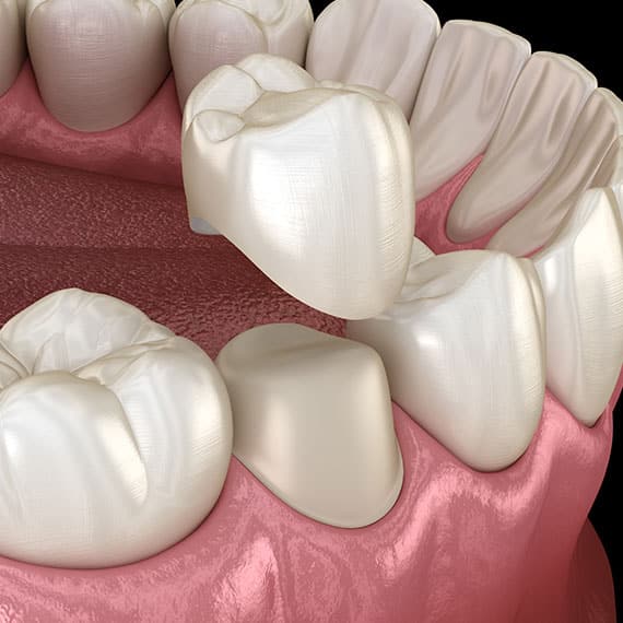 Restorative Dentistry Near You
