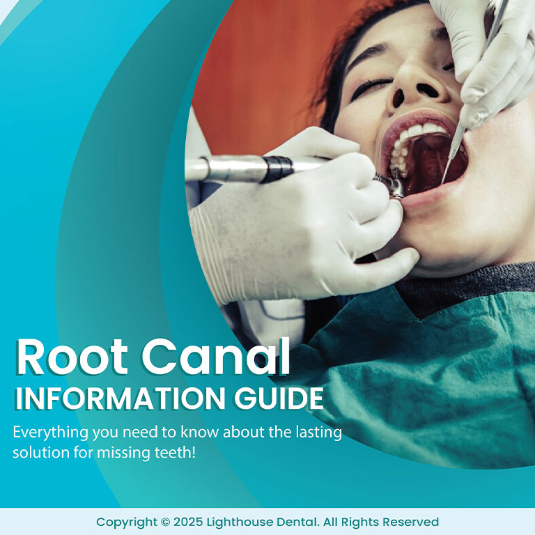 Root Canal Information Guide