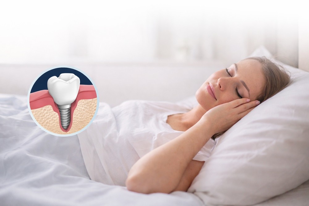 How Many Days Should I Rest After a Dental Implant?