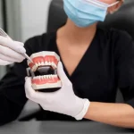 cosmetic dentures for improving smile appearance